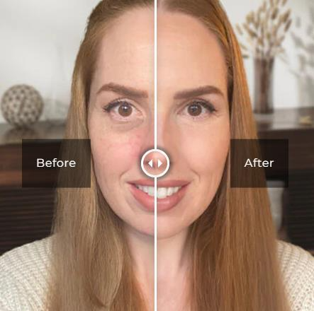 Anti-Aging Celyn Eye Cream for Dark Circles, Puffiness and Wrinkles