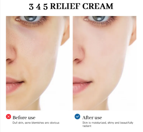 Lakerain Relief Cream Daily Hydration Facial Cream Lakerain 1.7 OZ